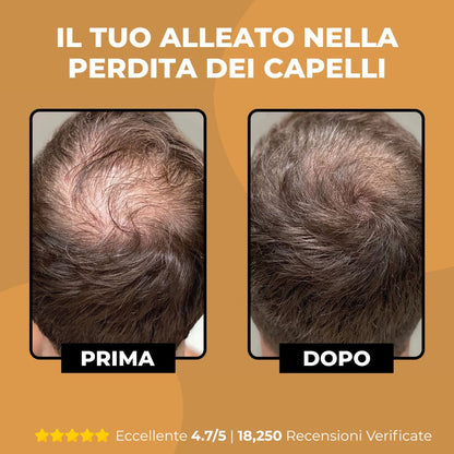 HairBoost - Shampoo Attivatore del Bulbo Pilifero dei Capelli